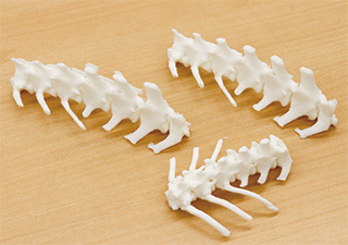 Skeletal model for preoperative simulation